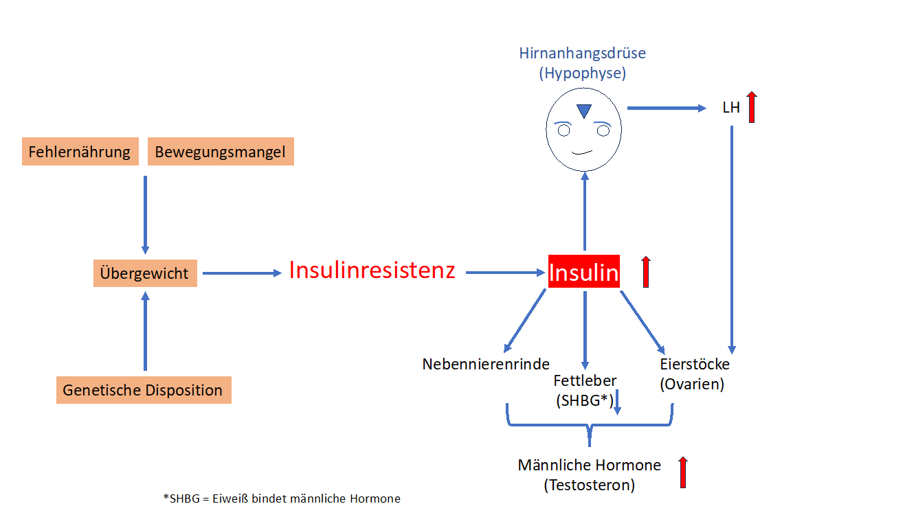 Das PCOS ist eine der häufigsten gynäkologisch